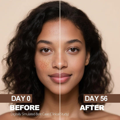 Radiant Skin Dark Spot Corrector™