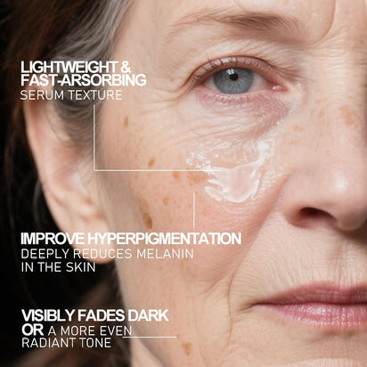 Radiant Skin Dark Spot Corrector™